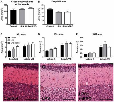 Erythropoietin Protects Against Lipopolysaccharide-Induced Microgliosis and Abnormal Granule Cell Development in the Ovine Fetal Cerebellum